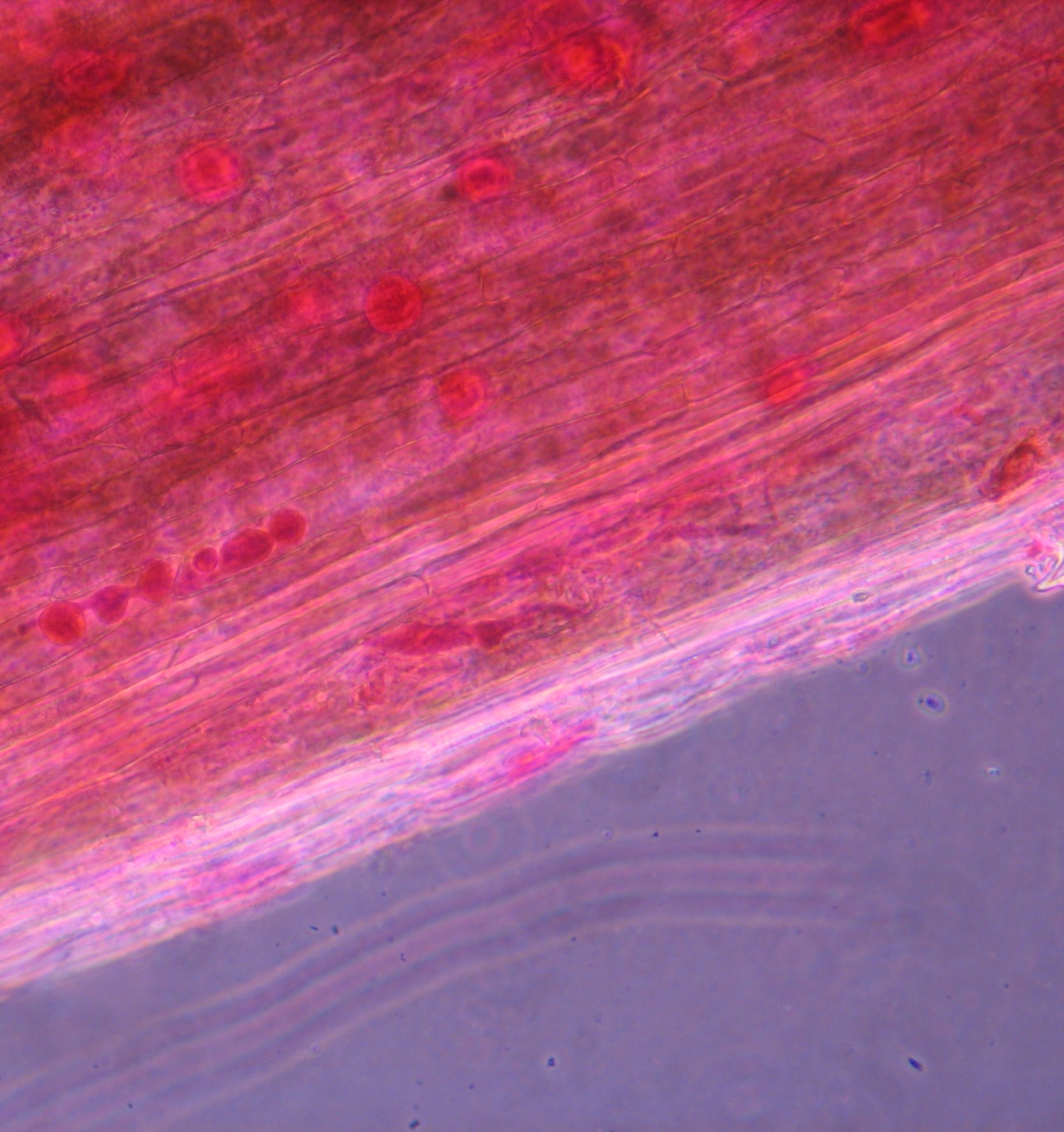 Bild 1. Oosporer av Pythium sp. insprängda i gräsets vävnad. Foto: Botaniska analysgruppen.